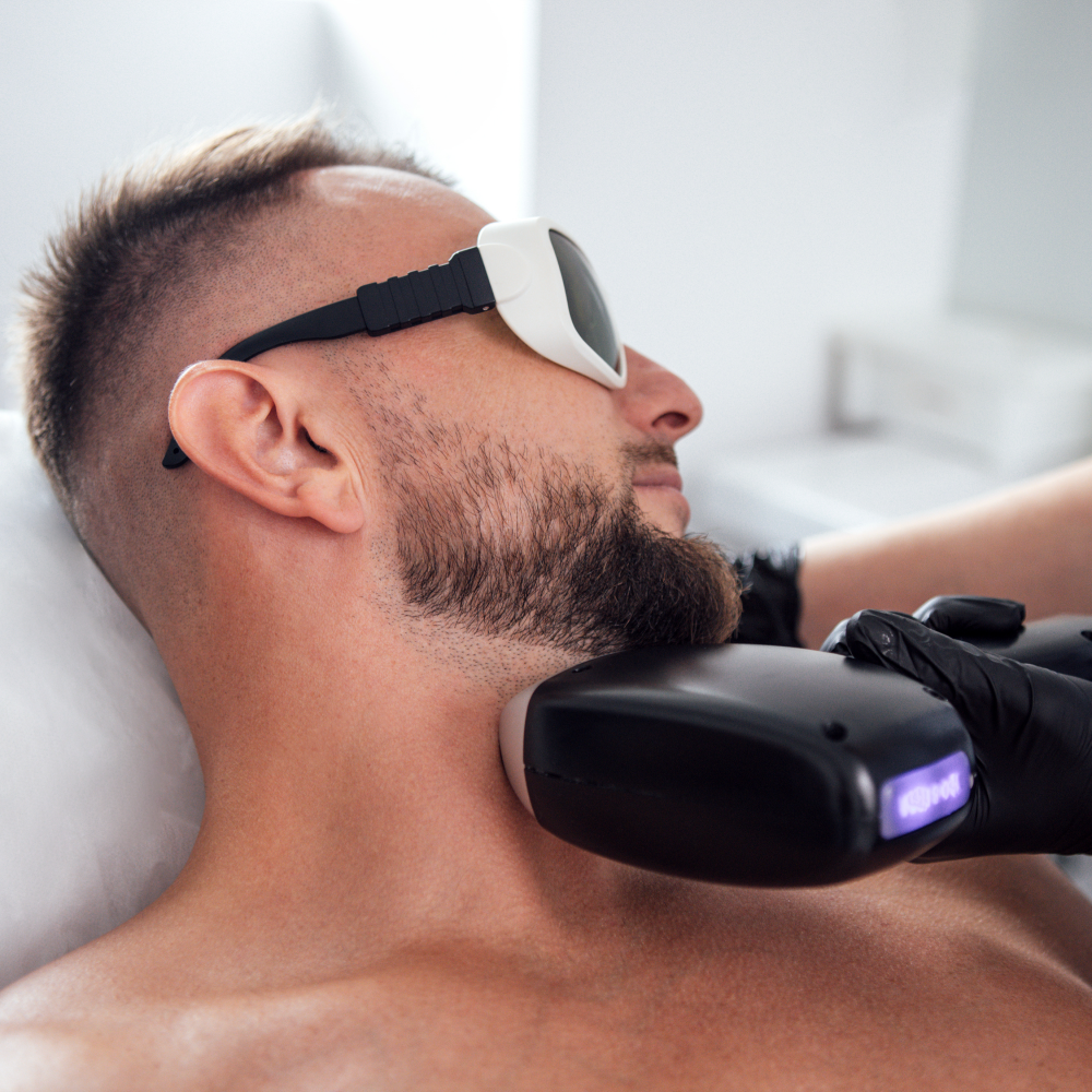 Laser Homme - Offre Perfection 8 séances