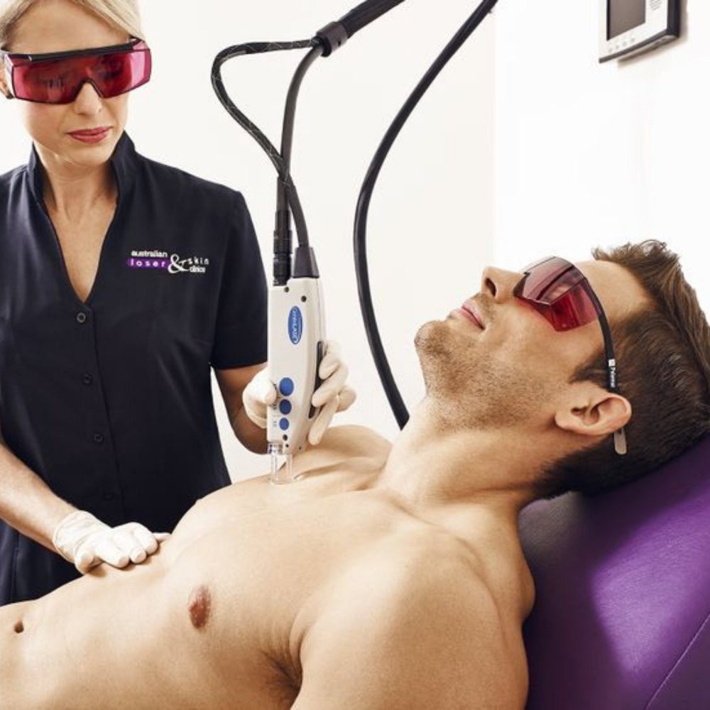 Laser Homme - Offre Perfection 3 séances